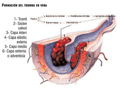 Figura 2.